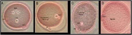 Different stages of rat oocytes development following Intracytoplasmic Sperm Injection.